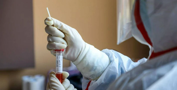 Confirmaron un caso de viruela símica en Río Gallegos y envían nuevas muestras para testeos